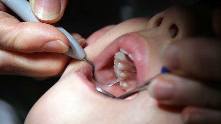 Vikten av regelbunden tandundersökning